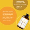 LOTUSJOY Chamomile Essential Oil, Pure Natural for Skin Body Hair