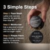 Shield System, Acne System for Men, Face Wash, Moisturizer, Pimple