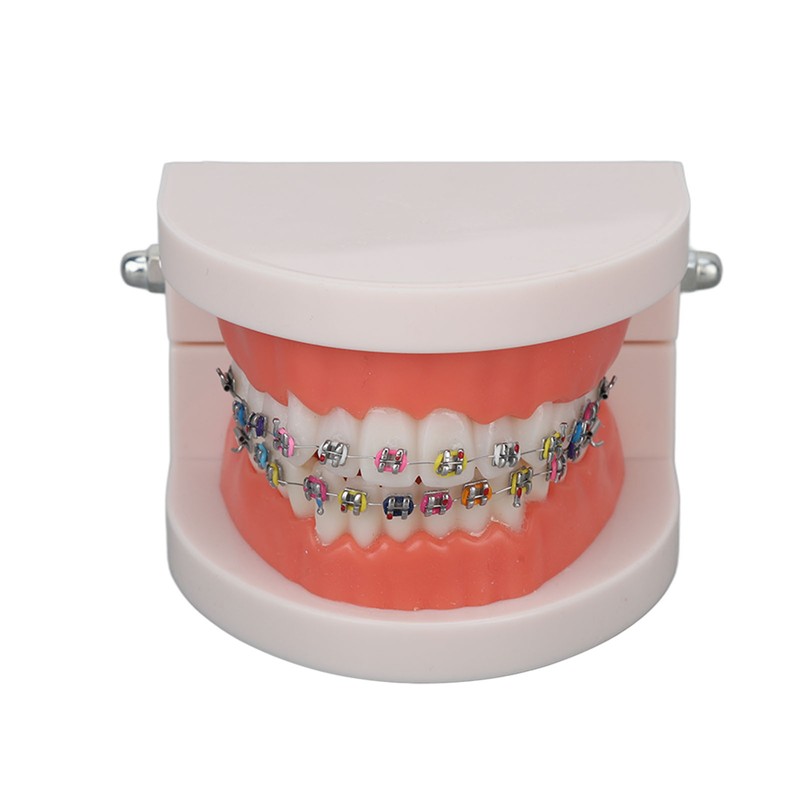 Dental Typodont Teeth Model with Orthodontic Metal Bracket for Dentist