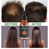 Adweekey Organic Batana Oil for Hair Growth, 100% Pure ,