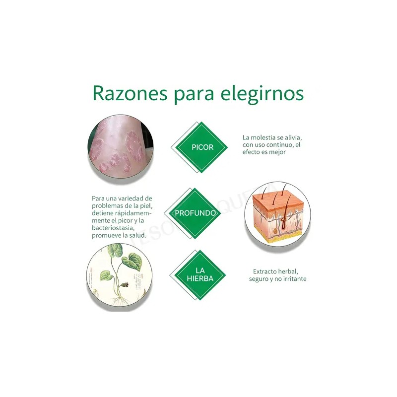 2p Crema De Psoriasis Para Varios Síntomas De Psoriasis 20g