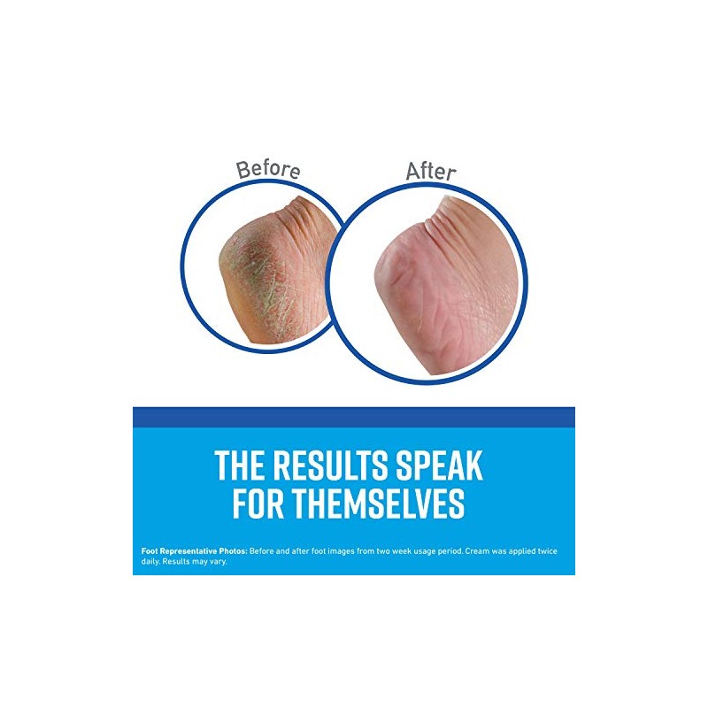 O'Keeffe's Healthy Feet crema de pies, frasco de 3.2 onzas.,