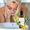Jabón Limpiador Facial De Árbol De Té, Controla Exceso De