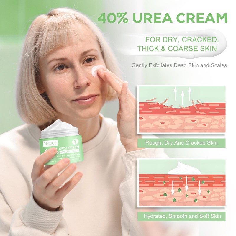 Urea Foot Cream 5.29 oz - Deep Moisturizing, Callus Remover