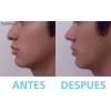 3D Rhinoplasty 7 Pzs Estilizador Corrector Nasal Tamaños Perfila Levanta