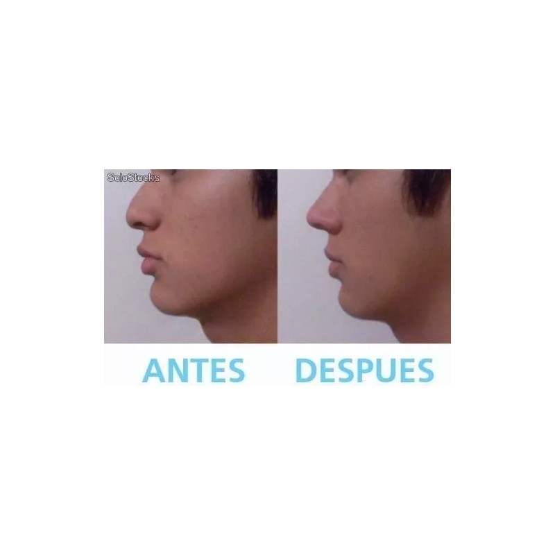3D Rhinoplasty 7 Pzs Estilizador Corrector Nasal Tamaños Perfila Levanta