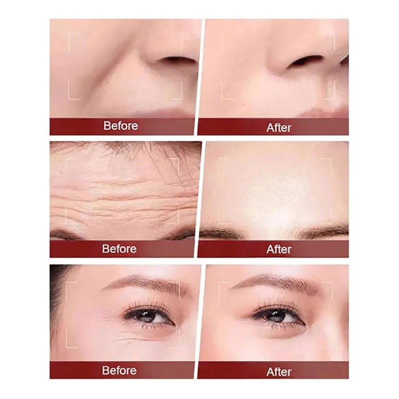 Crema Antiarrugas Milkydeck 377