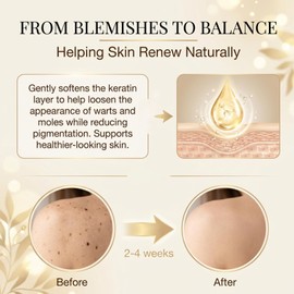 Sklight Dual-Action Renewal Cream, 2Pcs Black and White Rice Soothing Repair Cream, Natural Body Serum for Smooth-Looking Skin, Suitable for All Skin Types