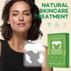 SILKDERMIS Forehead Wrinkle Patches 12Pcs with Smile Line Patches 24Pcs