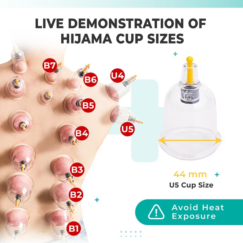 [100 Pack] Bulk Hijama Cups for Cupping - B1 B2
