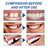 Resin Tooth Repair Glue Shapeable Teeth Gaps Filling Solid Temporary