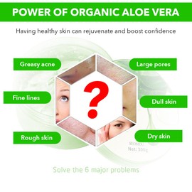 NAILKISS Aloe Vera Gel, Organic Moisturizing Cream Soothing and Hydrating for Face, Skin, Hair & Sunburn Relief, 100% Pure Aloe Gel for All Skin Types-300ml (10.1fl.oz)