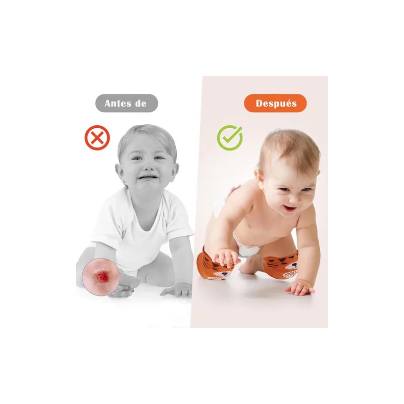 Set 5 Pares De Rodilleras Bebe Gatear Antiderrape