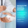 MED PRIDE Conforming Gauze Rolls First Aid Rolled Stretch Bandages