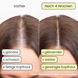 Enooso Organic Solid Shampoo Bar – Anti-Hair Loss Care with Rosemary Oil & Castor Oil – 100% Natural & Vegan Shampoo for Oily Hair – Strengthens Roots, Reduces Hair Fall, and Deeply Cleanses Scalp