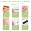 TDHZXEM Blackhead Remover,for Acne and Pimples Popping up Acne Extraction，4