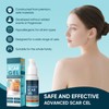 Scar Gel, Scar Cream, Advance Scar Gel for Surgical Scars