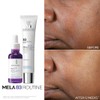 Roche Posay Mela Sérum Antimanchas Corrector Intensivo Niacinamida Melasyl Piel