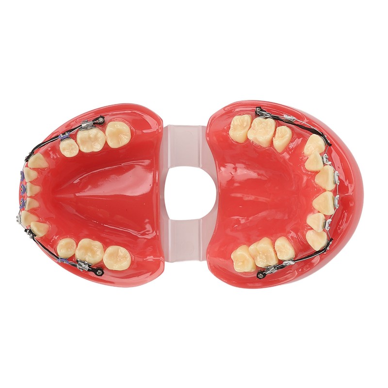 Professional Dental Demonstration Orthodontic Model with Metal Wires and Bracket