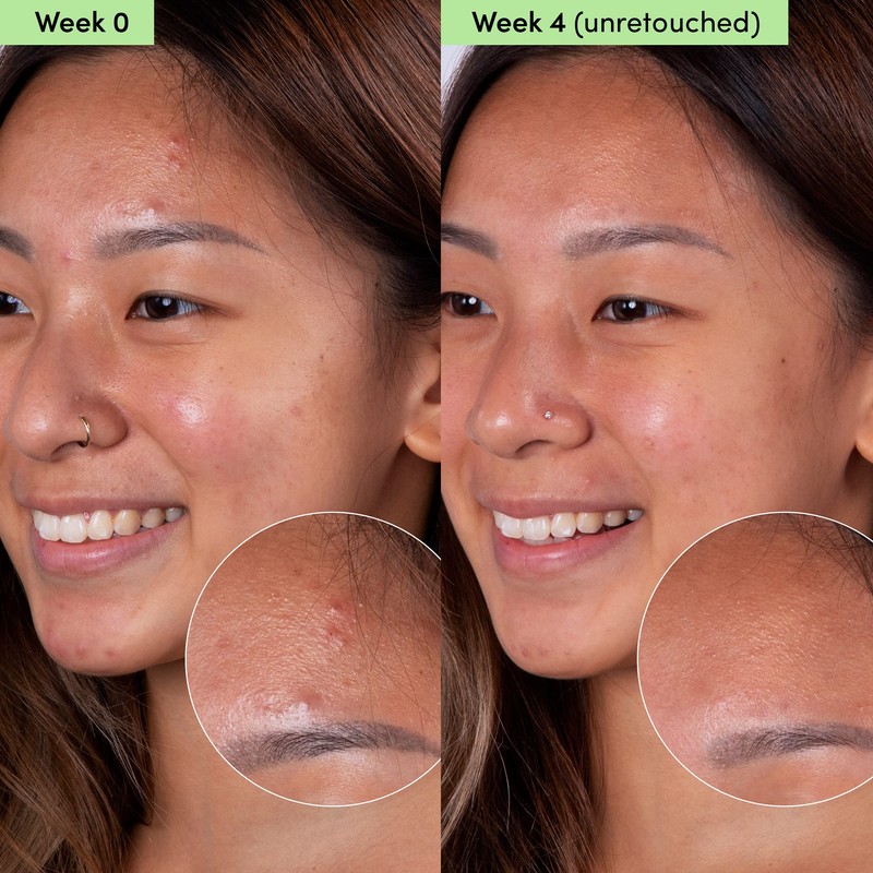 Sand & Sky Oil Control Blemish Clearing Clay Face Mask