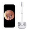 Smart Visible Ear Cleaner 10MP HD 360 Degree Wide Angle
