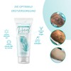 ENDLICH OHNE Tattooentfernung - Care/Aftercare for Laser-Treated Skin - Laser