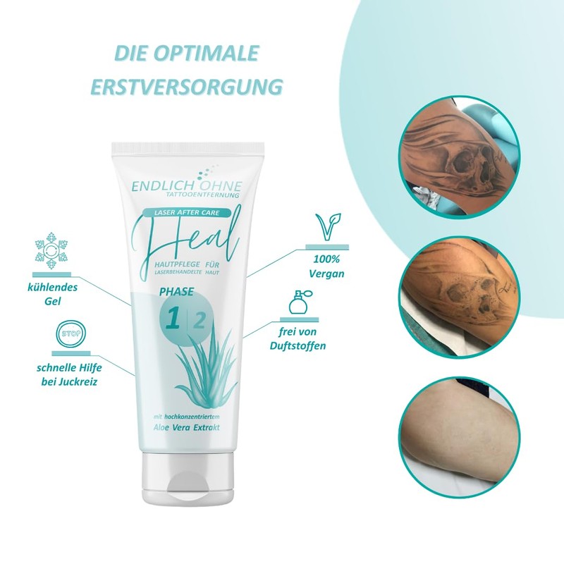 ENDLICH OHNE Tattooentfernung - Care/Aftercare for Laser-Treated Skin - Laser