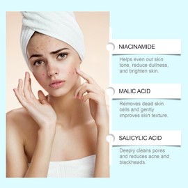 Bluemega Gel Hidratante con Niacinamida para el Acné Control de Grasa y Puntos Negros, Hidratación Ligera, Limpieza Profunda, Apto para Todo Tipo de Piel