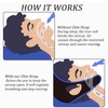 Chin Strap for Sleeping, Anti Snoring Chin Strap with Adjustable