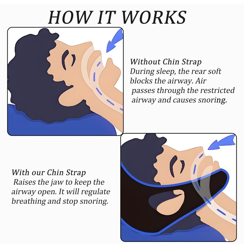 Chin Strap for Sleeping, Anti Snoring Chin Strap with Adjustable