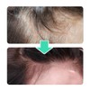 VT [Basic] VT PDRN Liddle Shot Scalp Ampoule 5 Bottles