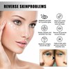 Peptide Eye Serum with Massage Roller – Under Eye Cream