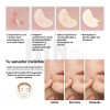 Parche Acné Y Cicatrices Kit 2 Pz Árbol De Té