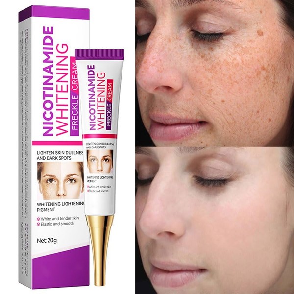 Axnoocy Dark Spot Remover Face Whitening Cream Quick Effect Niacinamide