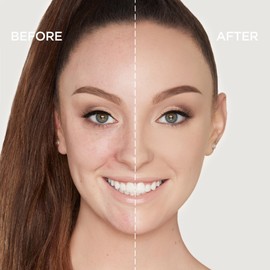 tarte babassu foundcealer dewy foundation Broad Spectrum SPF 20 Sunscreen – Foundation & Concealer in 1 with SPF, Vegan Skincare Makeup with Radiant Buildable Medium Coverage, Cruelty Free