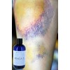 Arnica Bruise Cream Arnica Oil for Bruising Arnica Massage Oil
