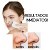 FUZE Limpiador Facial Exfoliador Ultrasonico Skin Scrubber Sonic