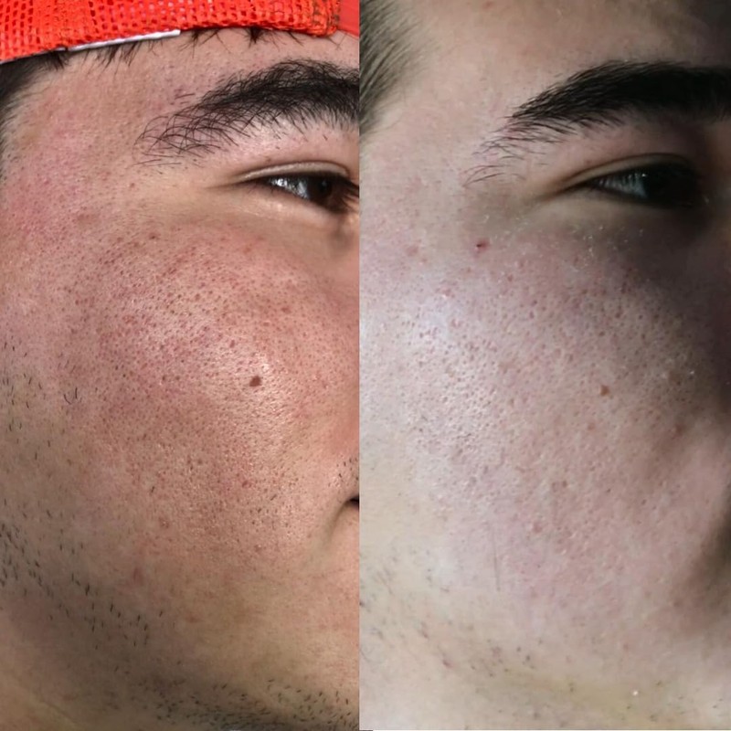 Pack x2 Jabones Aclarantes De Mi Má Ácido Kojico