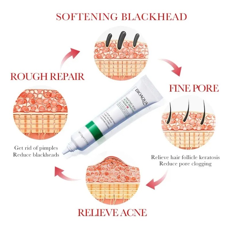 Crema Ácido Salicílico Bioaqua Control Acné Piel Grasa - Tratamiento