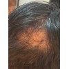 Shampo Sólido Artesanal, Natural Anticaída De Cabello