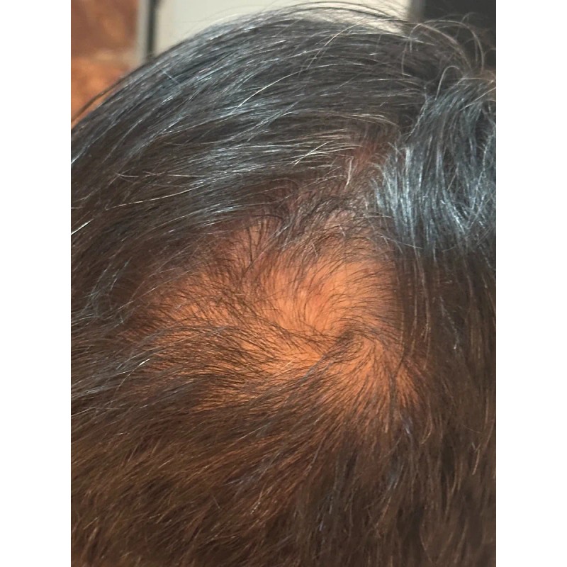 Shampo Sólido Artesanal, Natural Anticaída De Cabello