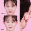 Cosmetic Ear Corrector Aesthetic Correctors for Celebrity Ears Solves the