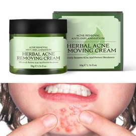 Acne Cream,Moisturiser Face Cream Spot Cream Mens Moisturiser Tea Tree Cream Spot Cream For Acne Cream Moisturiser for Women Men Teenagers Dilute Face Prone Spot Marks Balance Facial Oil Cream