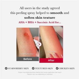 MEDICUBE [MEDICUBE]Red Acne Body Peeling Shot 2.0 110g
