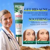 SDAOER TEA TREE ACNESOIL CONTROL ANTI-ACNE GEL 20g - Specification:
