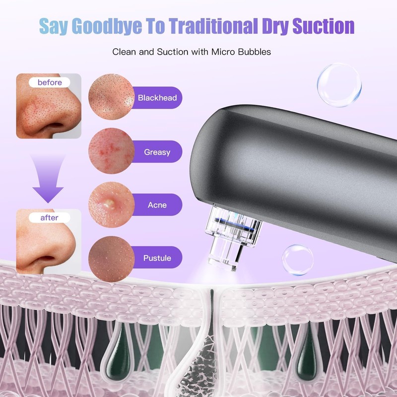 MMonDod Blackhead Remover Vacuum, 5 Probes Pore Sucker, 3 Modes,Grey