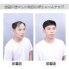 Sitengle 部分ウィッグ メンズ 頭頂部 人毛 男性用ウィッグ つむじはげ トップカバー ヘアトップピース 人工皮膚