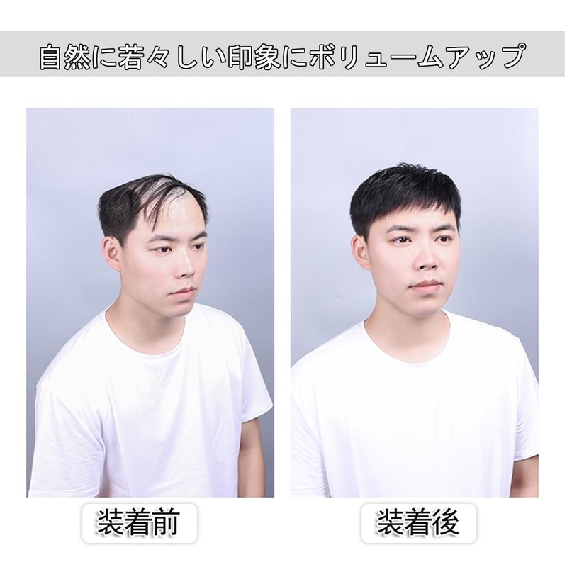 Sitengle 部分ウィッグ メンズ 頭頂部 人毛 男性用ウィッグ つむじはげ トップカバー ヘアトップピース 人工皮膚