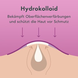 Rael Pimple Patches, Miracle Overnight Spot Cover - Hydrocolloid Acne Patches for Face, Zit and Blemish Spot, Thicker & Extra Adhesion, Acne Absorbing Cover, Vegan, Cruelty Free, 3 Sizes (52 Count)