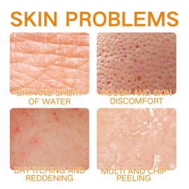 Vc Body Oil Gel - Body Oil for Women - Body Skin Care Oil Gel for Face,Body,Arm,Leg - Natural Vitamin C Essential Oils for Dry Skin - Hydrating Skin Care,Nourish,Easy Absorb